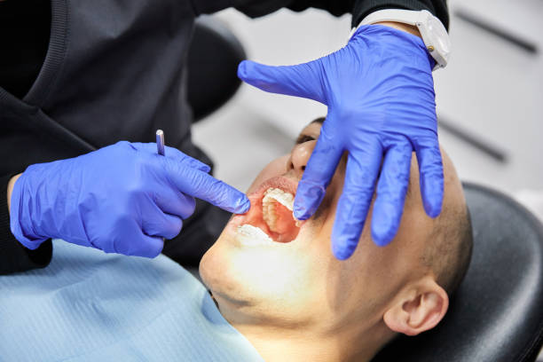 Best Emergency Wisdom Tooth Extraction in Waldorf, MD